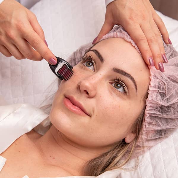 microneedling benefits