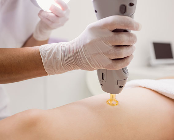 laser hair removal treatment benefits