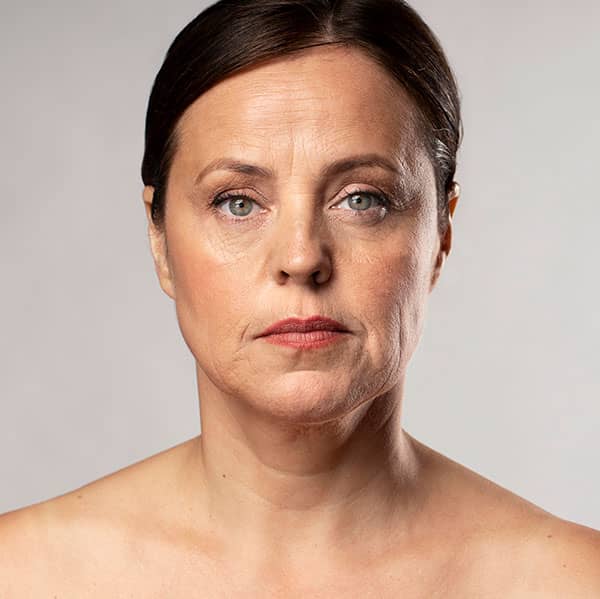 Juvederm