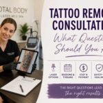 Tattoo Removal Consultation: What Questions Should You Ask?