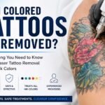 Can Colored Tattoos Be Fully Removed