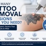 How Many Sessions Does Tattoo Removal Take