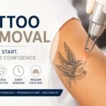 Is Tattoo Removal Worth It? Pros, Cost & Results Explained
