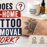 Does At-Home Tattoo Removal Work?