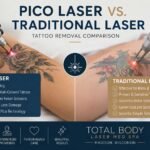 Pico Laser vs Traditional Laser Tattoo Removal