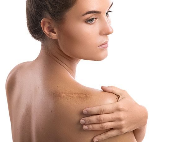 skin scar treatment with laser